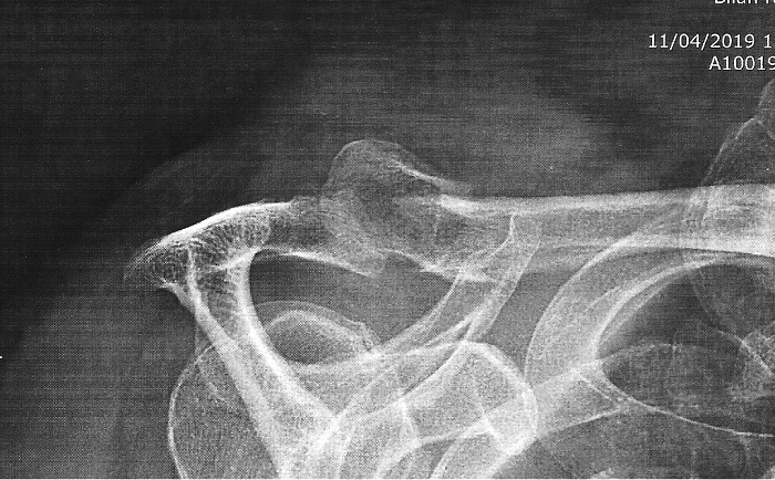 claviculex700.jpg
