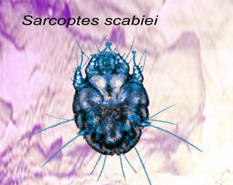 sarcoptes_scabiei.jpg