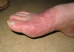 19122007-pied-malade-p.jpg